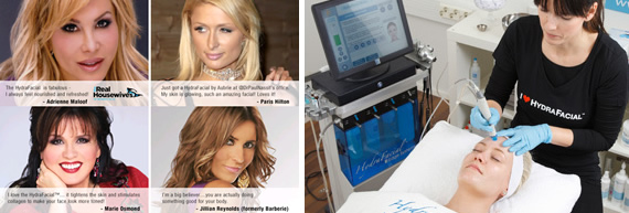 ハイドロフェイシャル