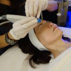 最新美容 ハイドラフェイシャルを体験！