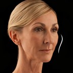 アジアパシフィック美容整形外科6月のキャンペーン