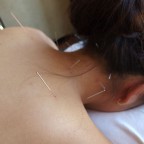 ビーチ沿いの癒し空間 ハワイではじめての鍼治療