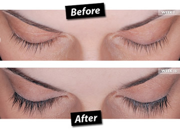 まつ毛の美容液 ラティス