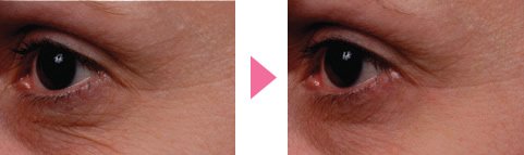 TNSエッセンシャルセラム