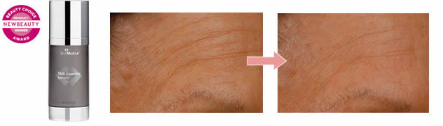 ハワイ美容整形 TNSエッセンシャルセラム